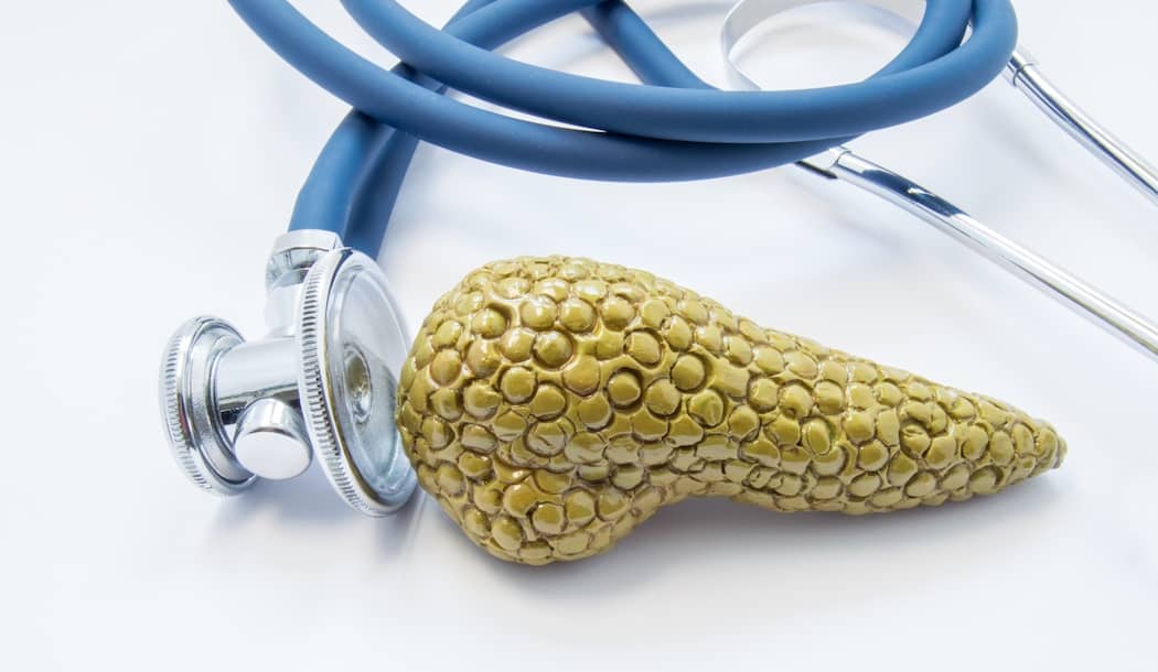 A List of Herbs that Can Slow or Reverse Pancreatic Cancer about undefined